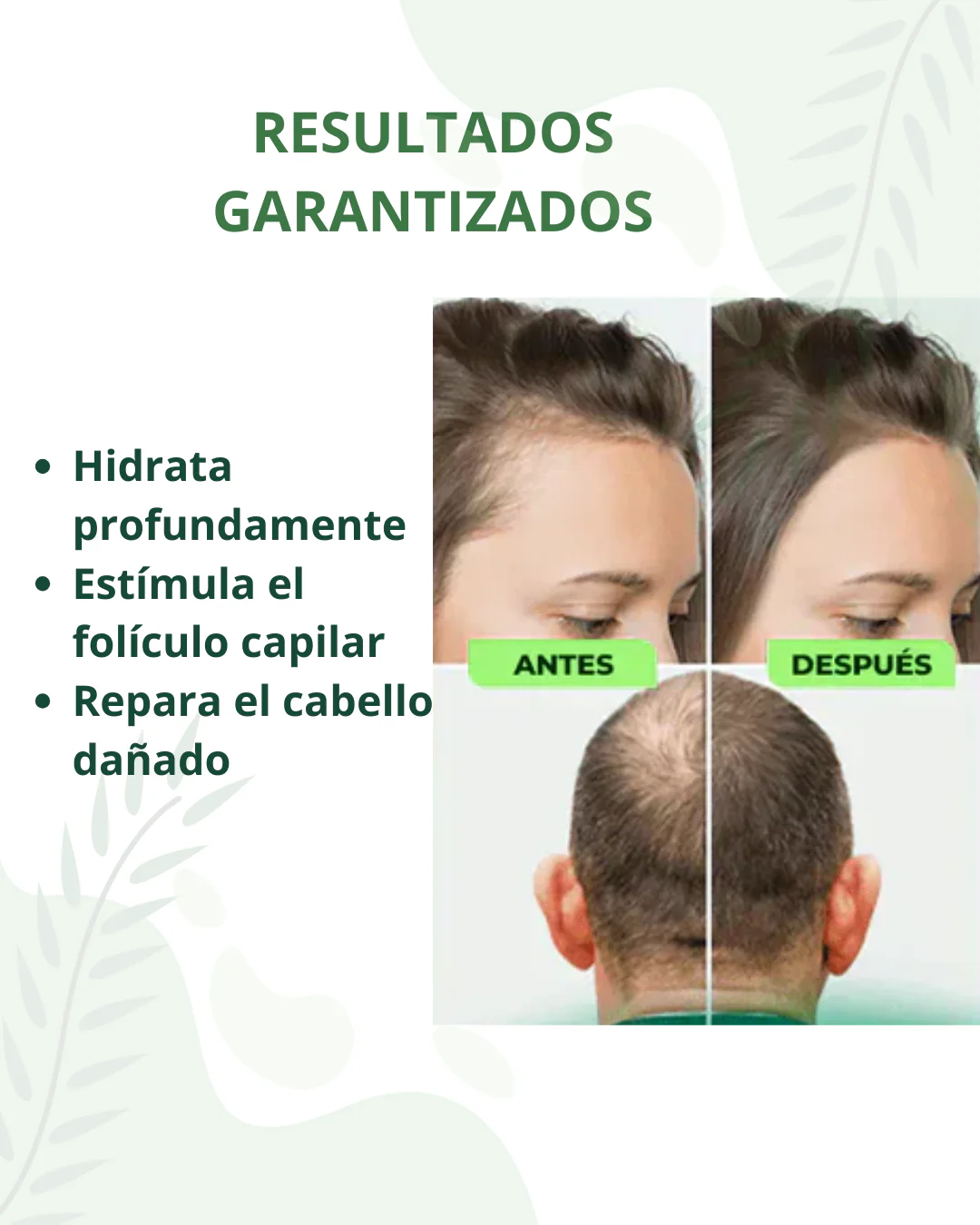 OUHOE™ | PARA TU CABELLO |